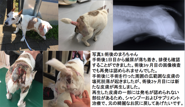 会陰ヘルニア３