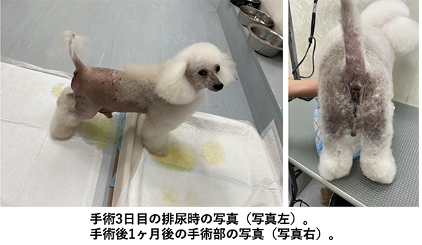 皮膚尿道瘻３